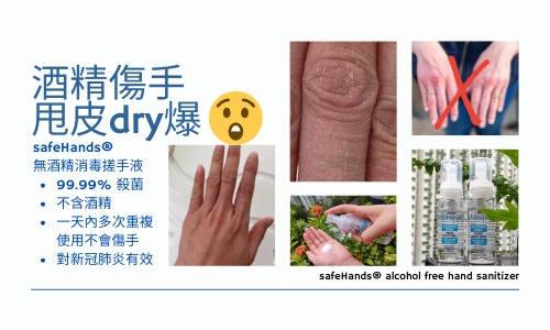 點解仲係要用消毒酒精捽手？